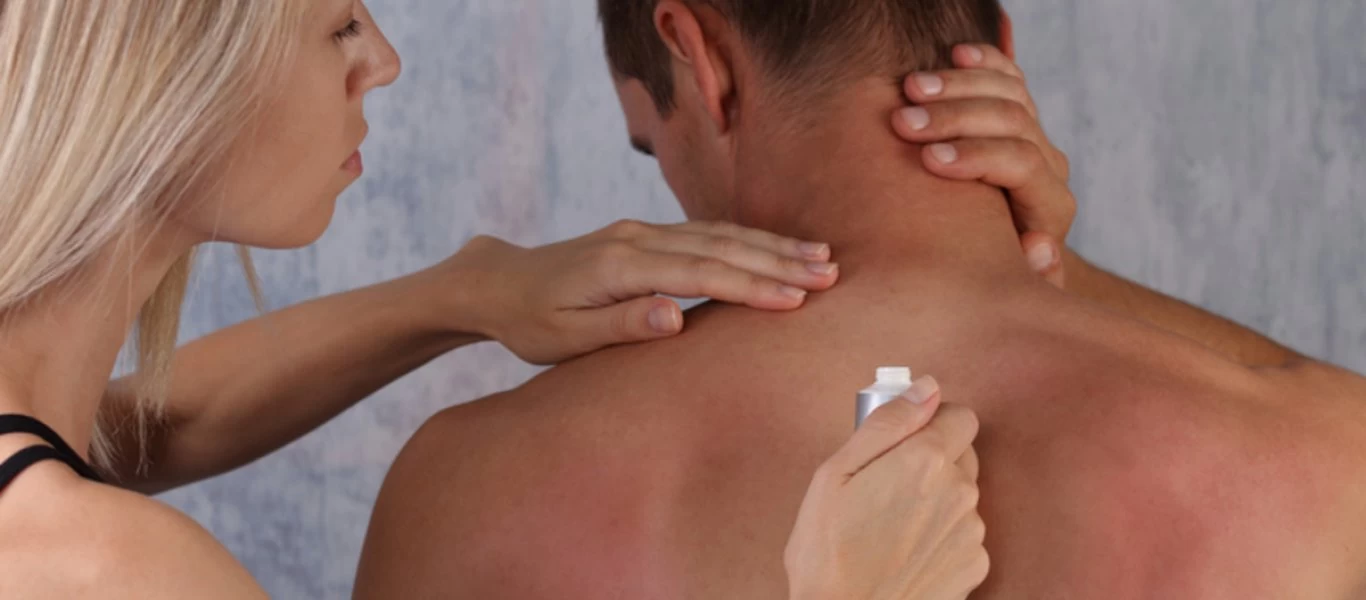 Ηλιακό έγκαυμα: Τα συμπτώματα και πως να ανακουφιστείτε με φυσικό τρόπο